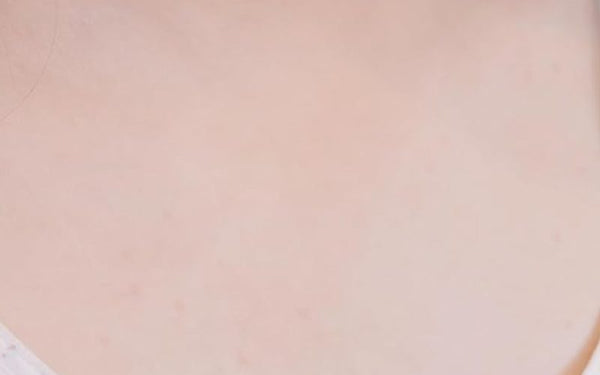 El mismo brazo, con la piel de gallina más fina, después de usar el spray