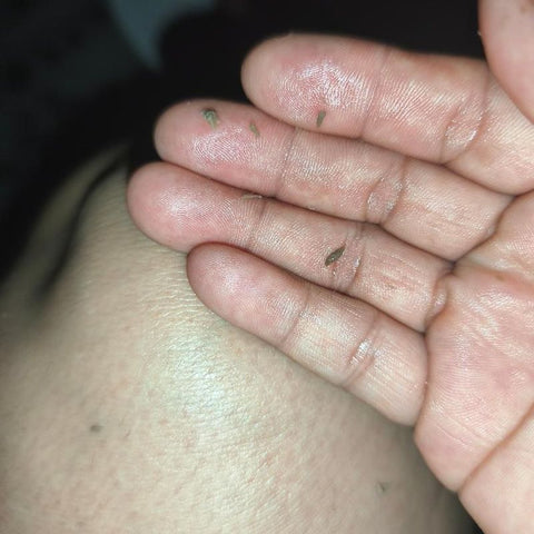 Foto de la reseña de Sulemy ML: la piel con el residuo que sale al frotar