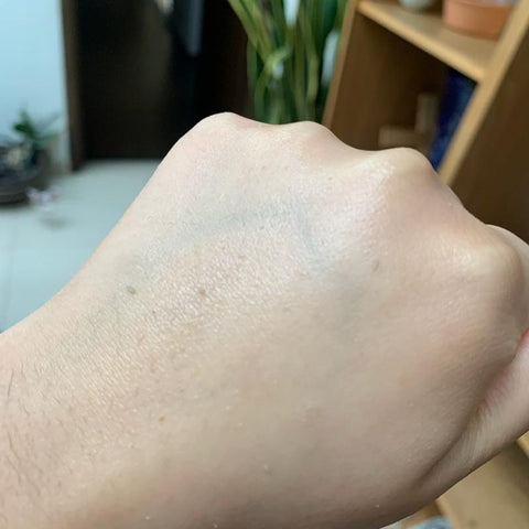 Foto de la reseña de Aleydis Martinez: su mano con las bolitas de piel muerta