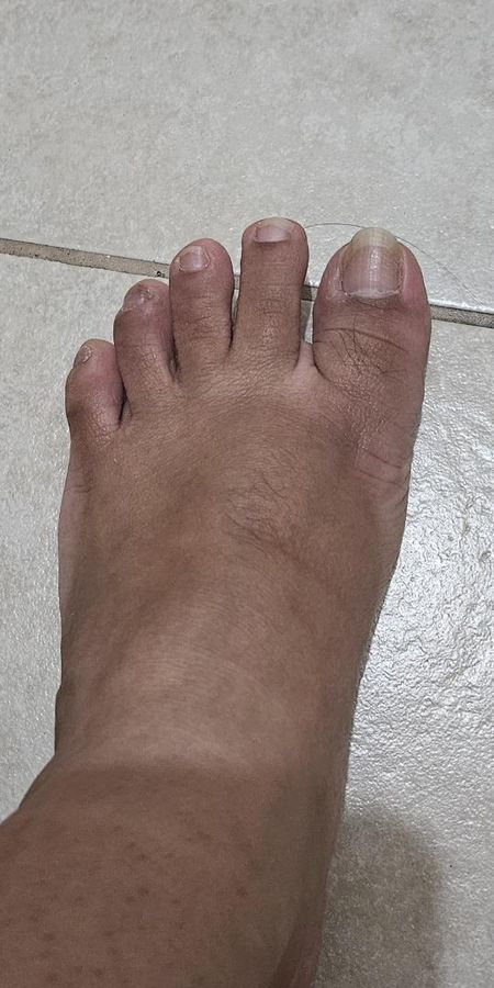 El pie de Ambar Nikols después de usar el spray
