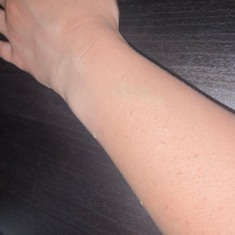 Foto de la reseña de ananerea199: su brazo después de la exfoliación