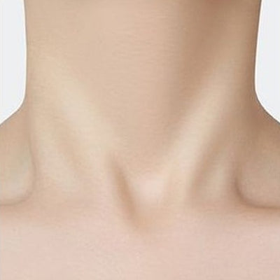 El mismo cuello después