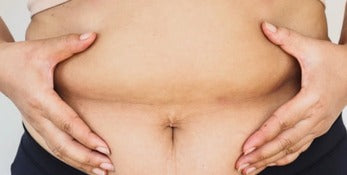 Dos manos sobre un abdomen hinchado